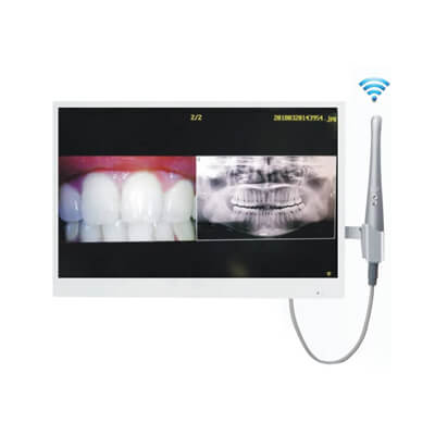 Oralkameras und Monitore