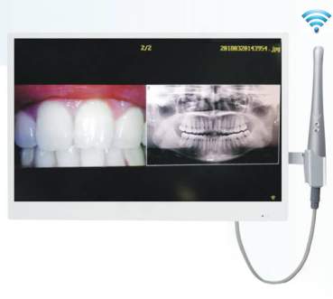 Oralkamera mit 18.5" Monitor